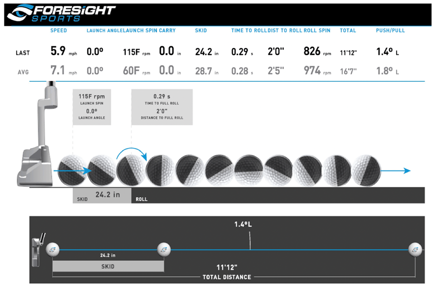 Foresight GC Quad